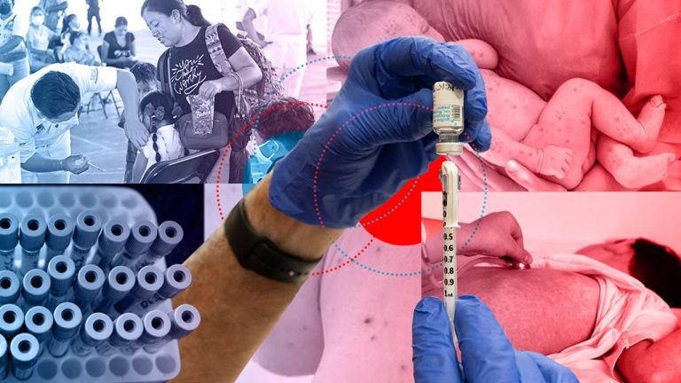 🔴 Alerta sanitaria por sarampión en México: refuerzan vacunación en todo el país